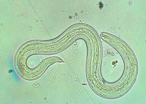 rat lung worm